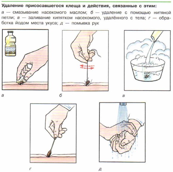 Реферат: Клещевой энцефалит